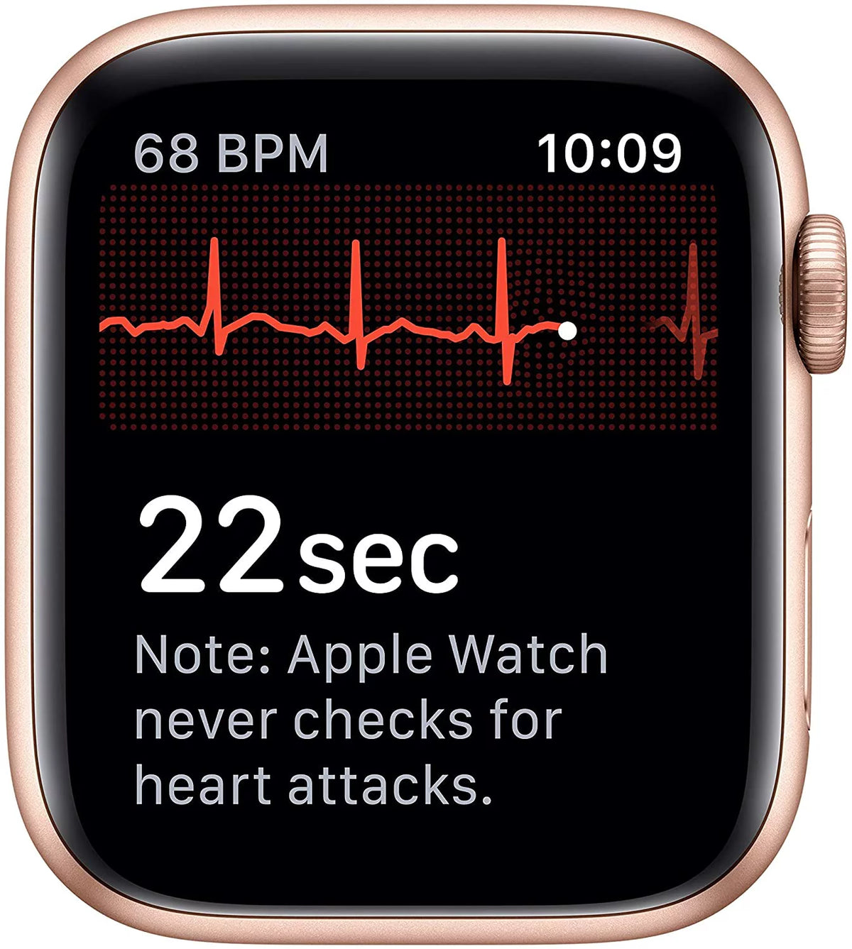Gold 40MM Apple Watch X381059